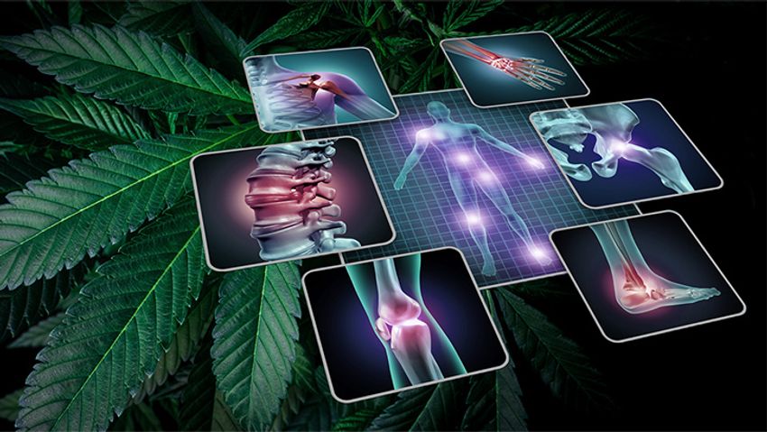  Study: Chronic Pain Patients Frequently Report Using Cannabis In Place of Opioids