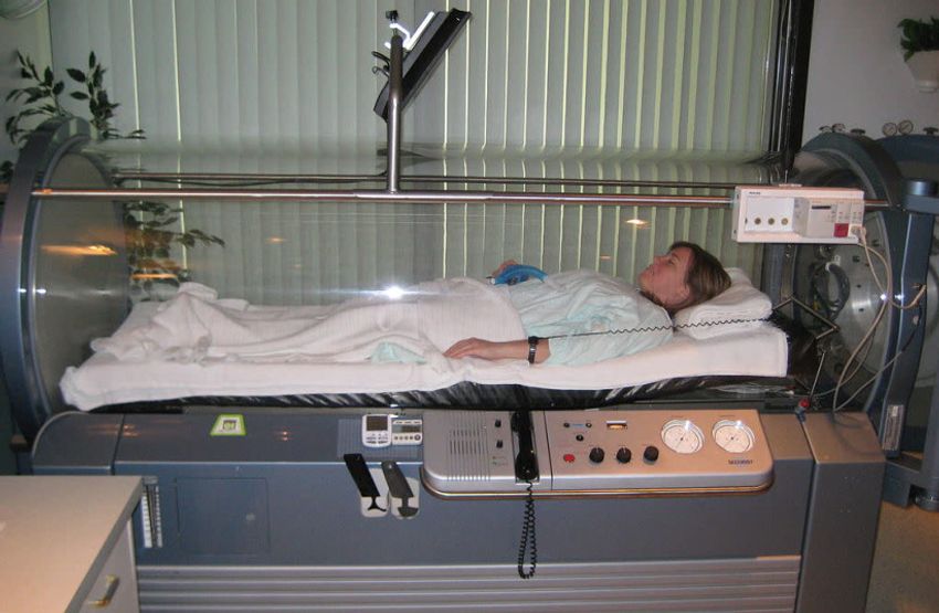  Hyperbaric oxygen therapy more effective for fibromyalgia than drugs