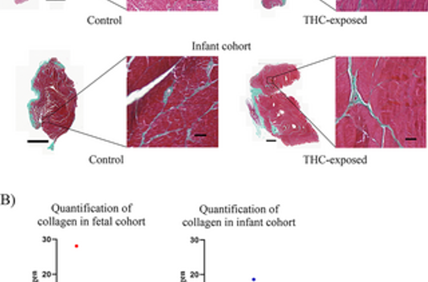  Effects of in utero delta-9-tetrahydrocannabinol (THC) exposure on fetal and infant musculoskeletal development in a preclinical nonhuman primate model