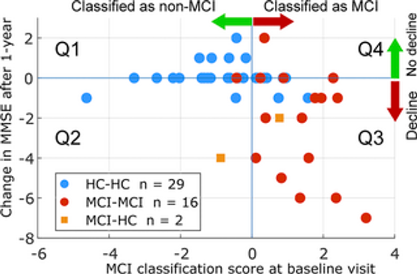  EEG and ERP biosignatures of mild cognitive impairment for longitudinal monitoring of early cognitive decline in Alzheimer’s disease