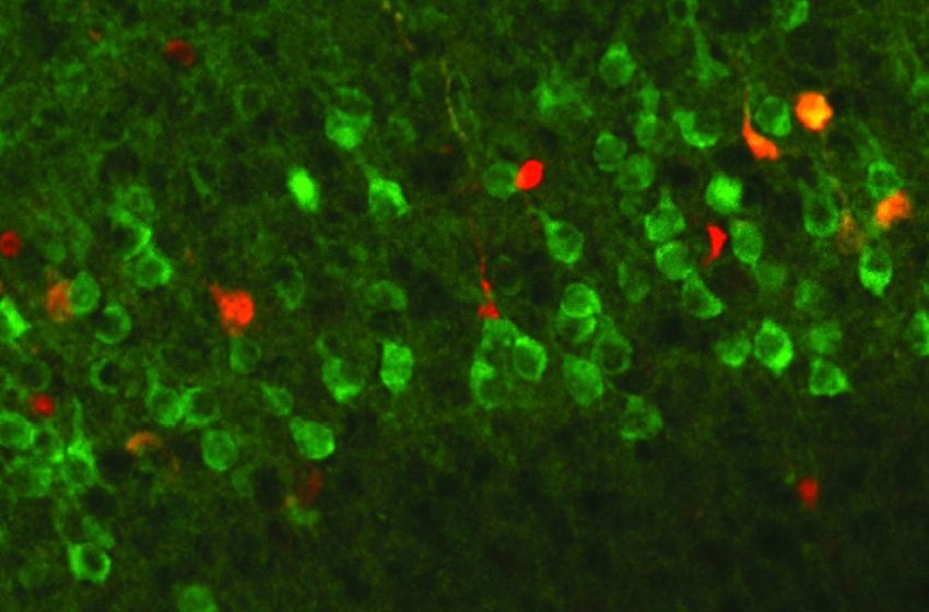  Cells and Molecules Underpinning Cannabis-Related Variations in Cortical Thickness during Adolescence