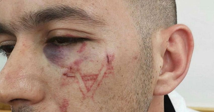  Four border policemen indicted for stamping Star of David on Palestinian’s face, destroying evidence